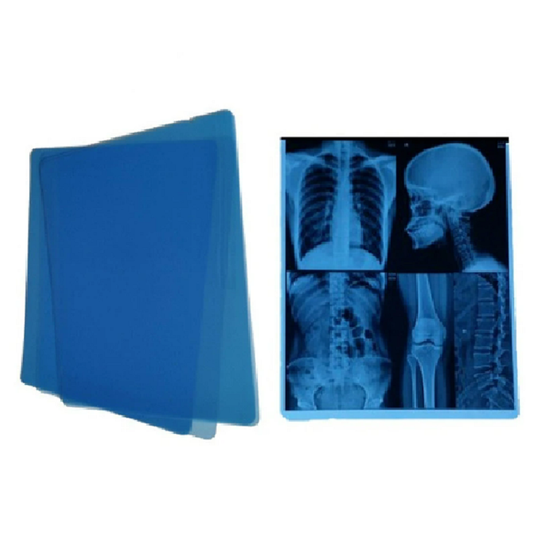 Плівка рентгенівська